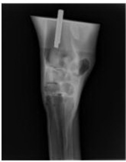 VSI14-Radiologick&aacute; předn&iacute; končetina koně-RTG2